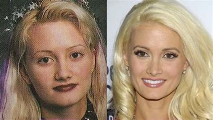 Holly Madison Has Admitted Having A Nose Job; Before Pictures